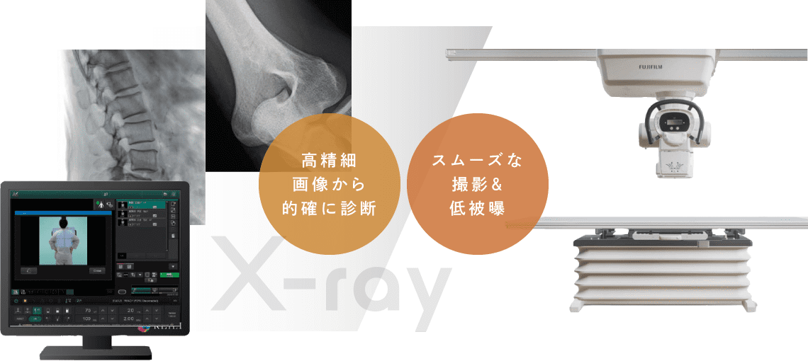 高精細画像から的確に診断/スムーズな撮影&低被曝