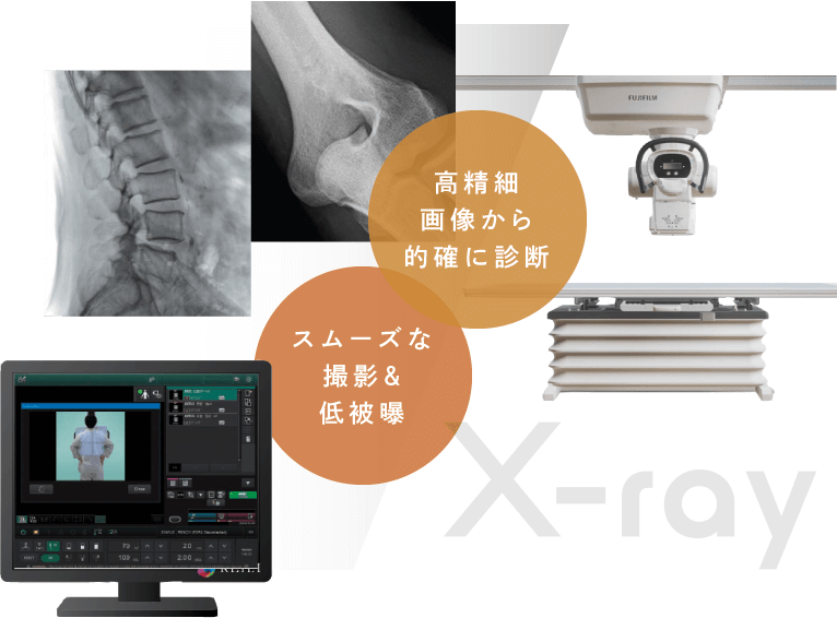 高精細画像から的確に診断/スムーズな撮影&低被曝